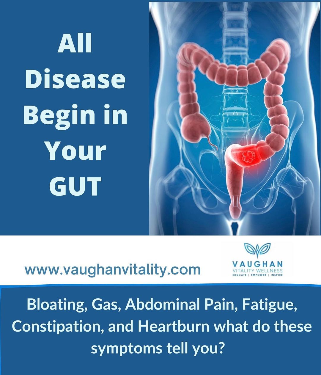 All Disease begins in your gut
